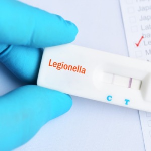 The control of legionella bacteria in Theatre water systems